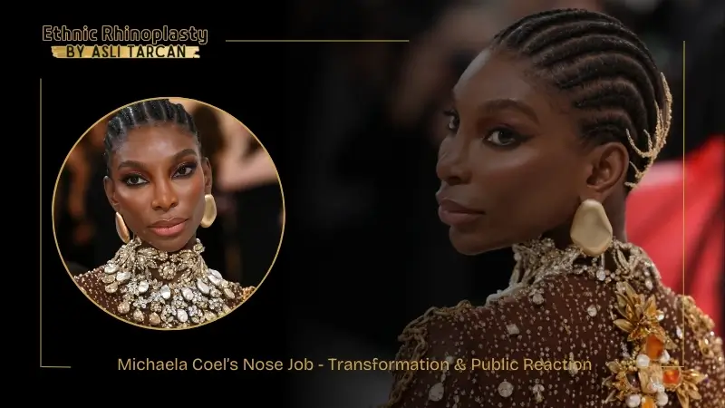 Michaela Coel’s Nose Job - Transformation & Public Reaction Michaela Coel’s Nose Job - Transformation & Public Reaction