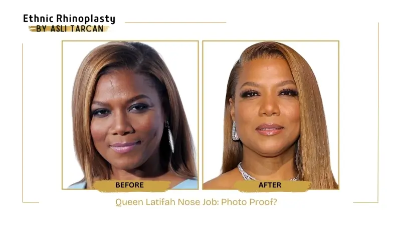 Queen Latifah Nose Job Photo Proof Queen Latifah Nose Job Photo Proof