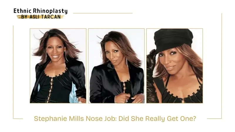 Stephanie Mills Nose Job Did She Really Get One Stephanie Mills Nose Job Did She Really Get One