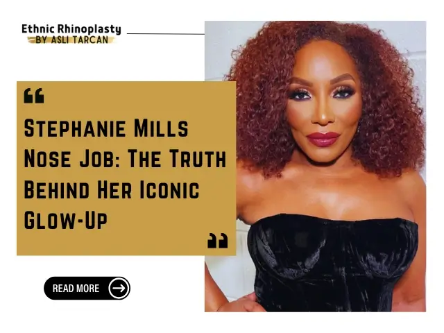 Stephanie Mills Nose Job