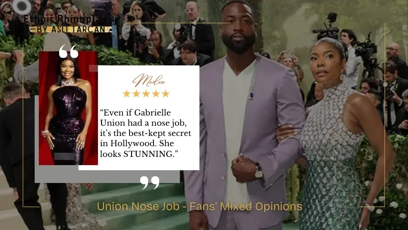 Union Nose Job - Fans’ Mixed Opinions - Tweet Union Nose Job - Fans’ Mixed Opinions - Tweet