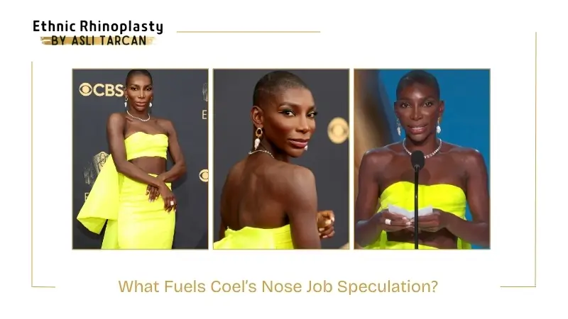 What Fuels Coel’s Nose Job Speculation What Fuels Coel’s Nose Job Speculation