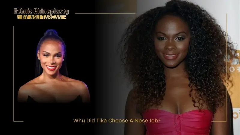 Why Did Tika Choose A Nose Job Why Did Tika Choose A Nose Job
