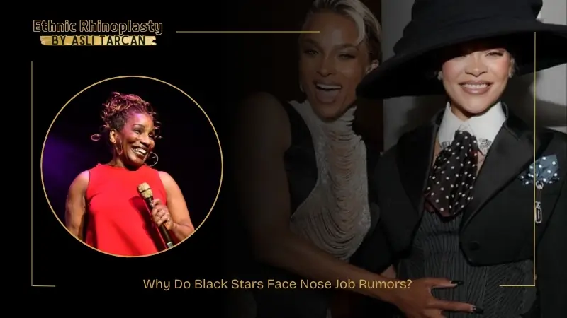 Why Do Black Stars Face Nose Job Rumors Why Do Black Stars Face Nose Job Rumors