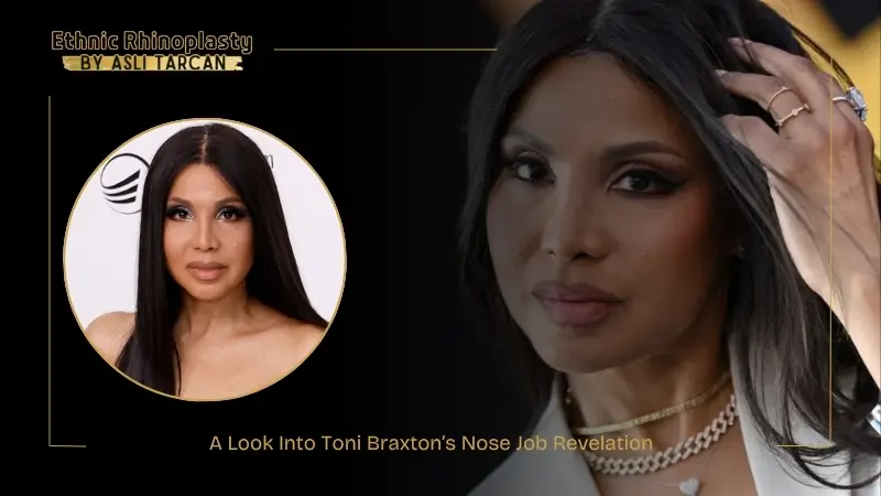 A Look Into Toni Braxton’s Nose Job Revelation A Look Into Toni Braxton’s Nose Job Revelation