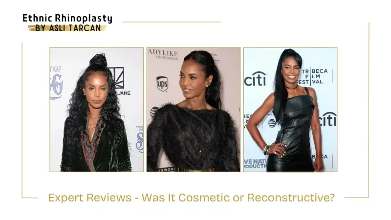 Expert Reviews - Was It Cosmetic or Reconstructive Expert Reviews - Was It Cosmetic or Reconstructive