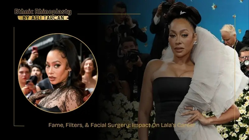 Fame, Filters, & Facial Surgery Impact On Lala’s Career