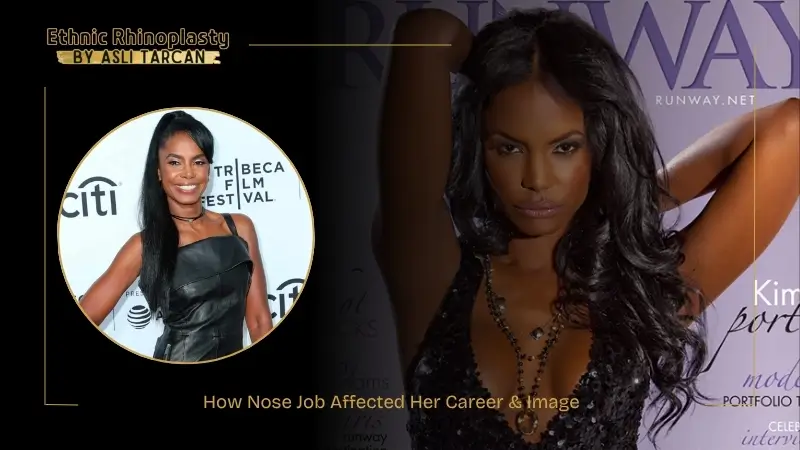 How Nose Job Affected Her Career & Image How Nose Job Affected Her Career & Image