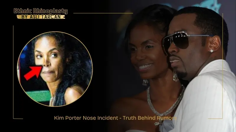 Kim Porter Nose Incident - Truth Behind Rumors Kim Porter Nose Incident - Truth Behind Rumors