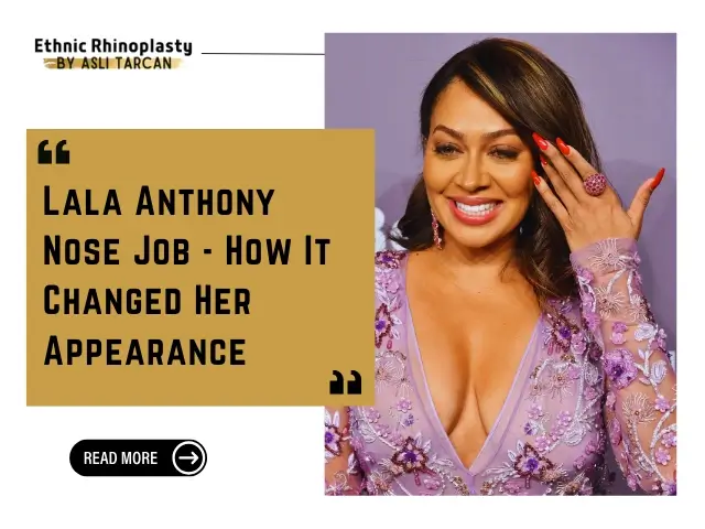Lala Anthony Nose Job