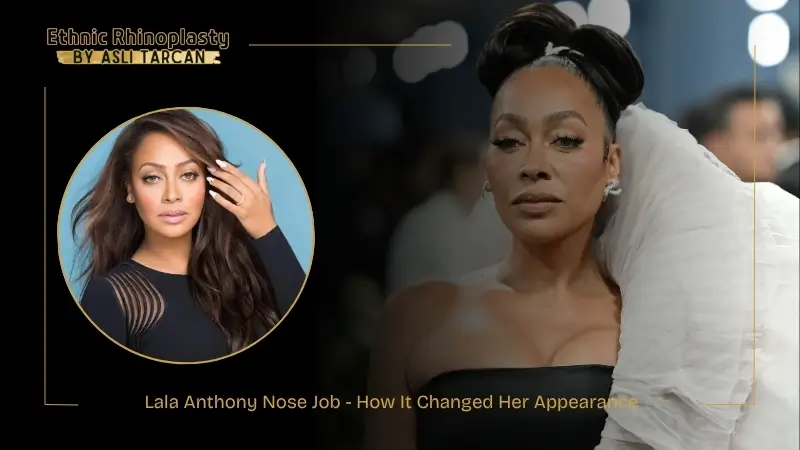 Lala Anthony Nose Job