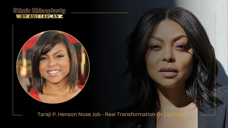 Taraji P. Henson Nose Job - Real Transformation Or Lighting