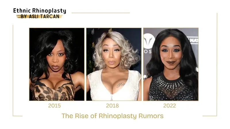 The Rise of Rhinoplasty Rumors The Rise of Rhinoplasty Rumors