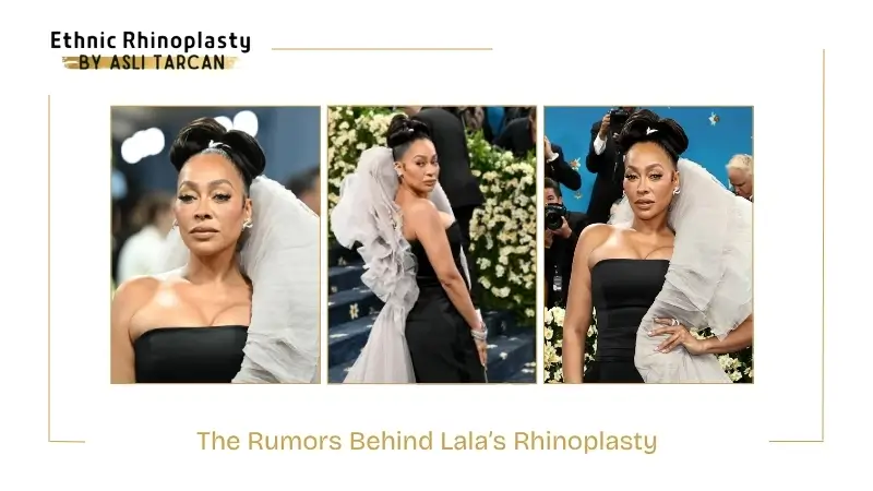 The Rumors Behind Lala’s Rhinoplasty