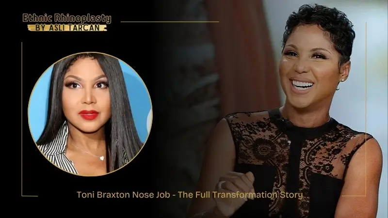 Toni Braxton Nose Job - The Full Transformation Story Toni Braxton Nose Job - The Full Transformation Story