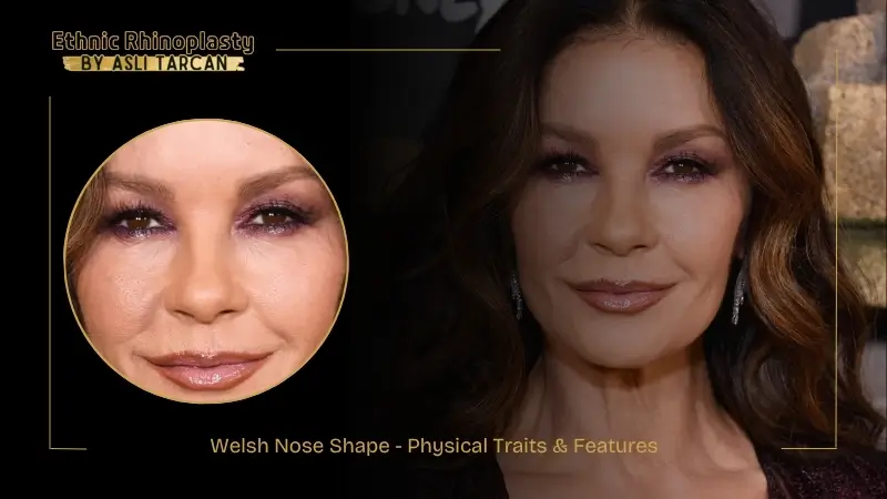 Welsh Nose Shape - Physical Traits & Features