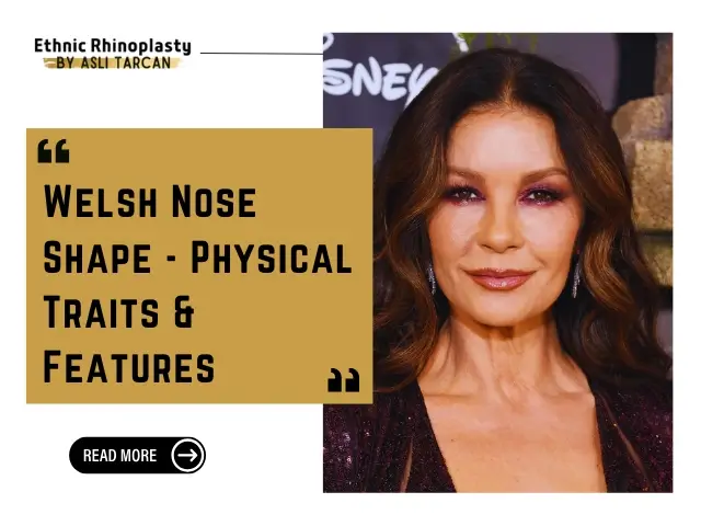 Welsh Nose Shape