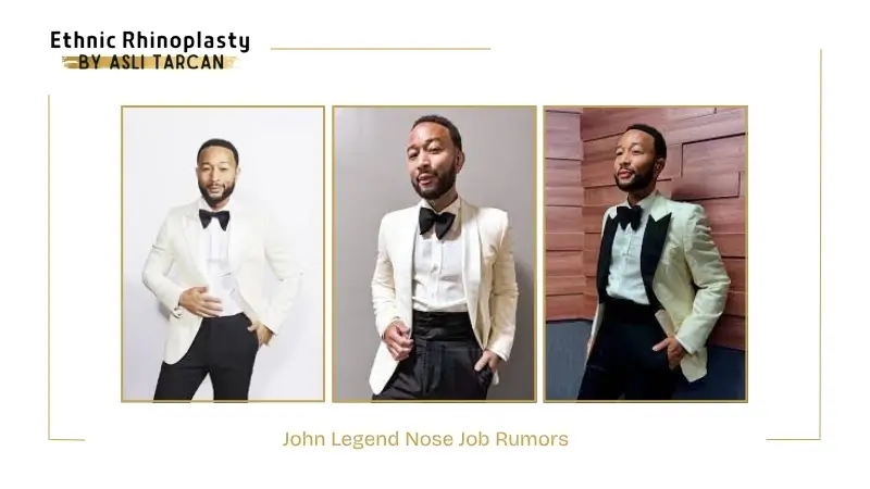 John Legend Nose Job Rumors John Legend Nose Job Rumors