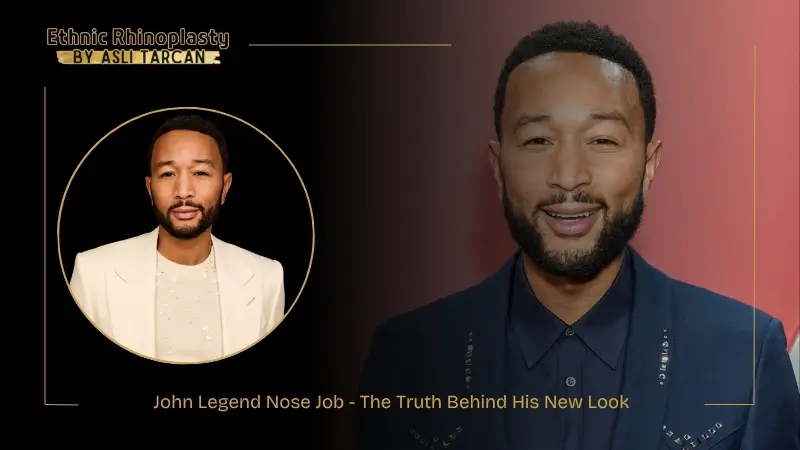 John Legend Nose Job - The Truth Behind His New Look John Legend Nose Job - The Truth Behind His New Look
